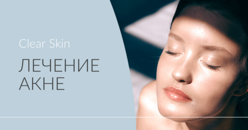 Лазерное лечение акте Clear Skin