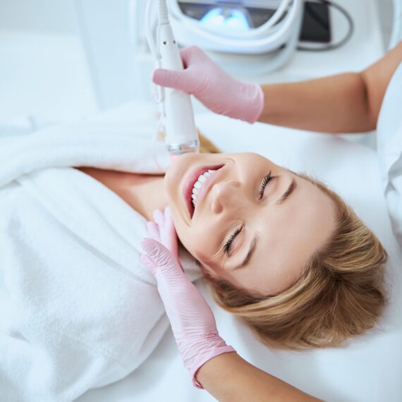 RF Microneedling