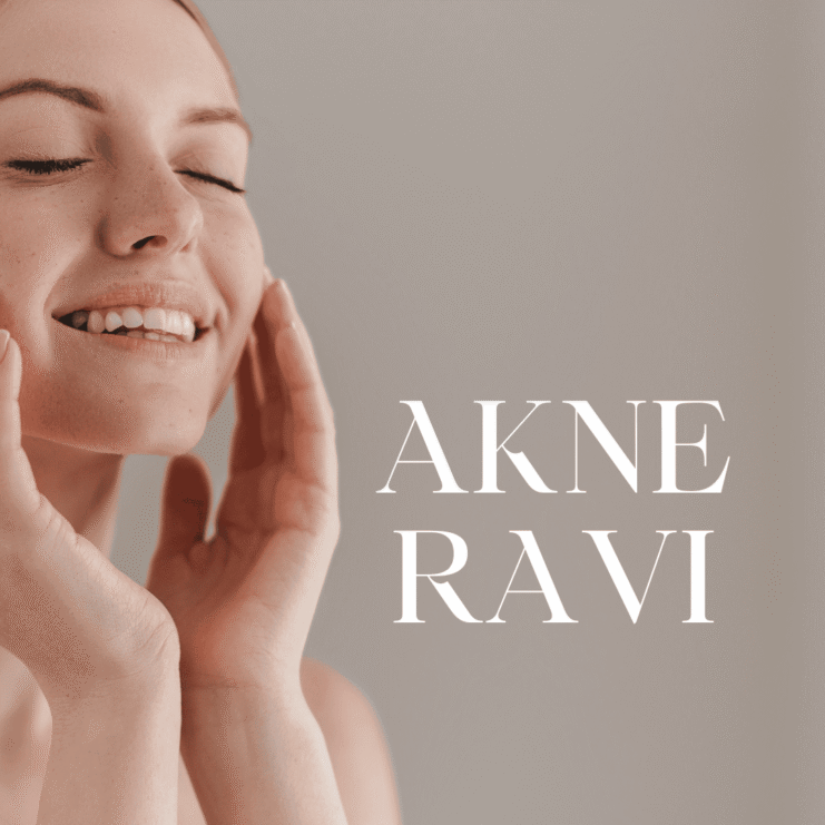 Akne ravi