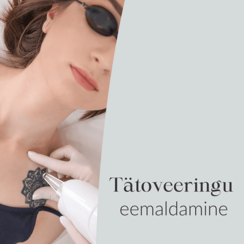 Tätoveeringu eemaldamine