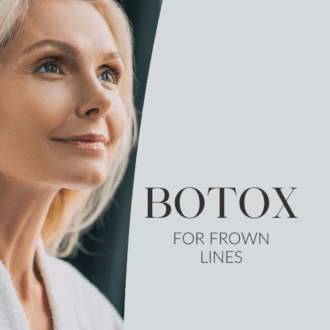 Botox_ kurjusekortsule 1080x1080px web ENG