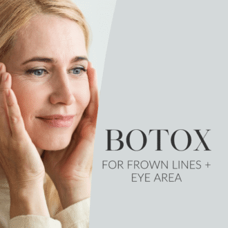 Botox_ kurjusekortsule ja silmaümbruse kortsudele web 1080x1080px EST (2)