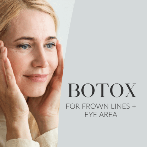 Botox_ kurjusekortsule ja silmaümbruse kortsudele web 1080x1080px EST (2)