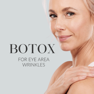 Botox_ silmaümbruse kortsudele web 1080x1080px EST (2)