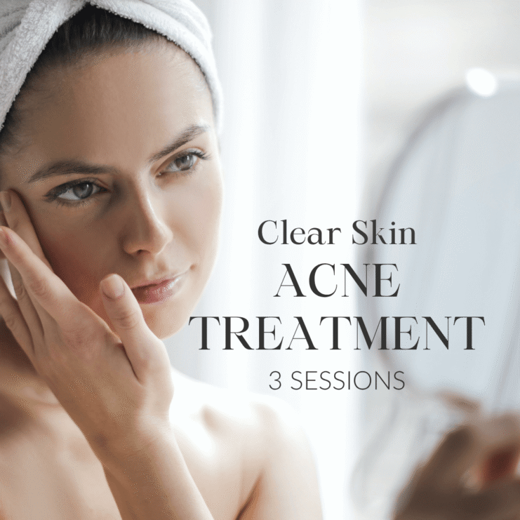 Clear Skin akne ravi laseriga 3x pakett web 1080x1080px ENG