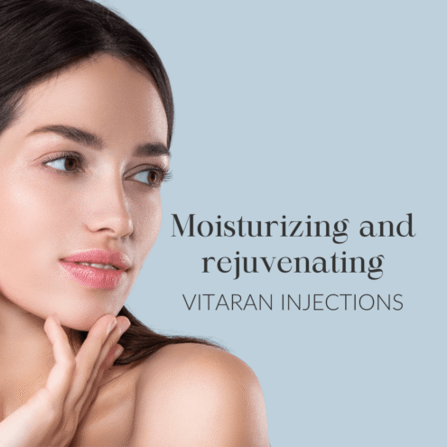 Niisutavad Vitaran süstid web 1080x1080px ENG