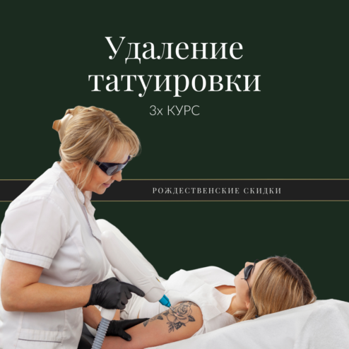 Tätoveeringu eemaldamine - Christmas 2025 - WEB offers - RUS