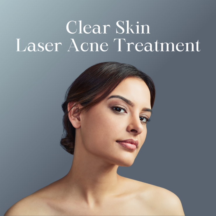 Clear Skin akne ravi laseriga 1080x1080px WEB ENG