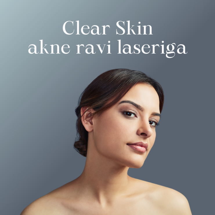 Clear Skin akne ravi laseriga 1080x1080px WEB EST