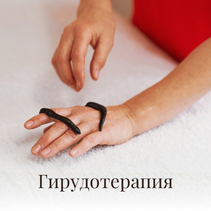 Hirudoteraapia _ WEB offers _ (1080x1080px) RUS
