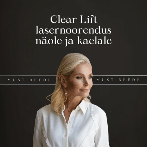 Clear Lift lasernoorendus näole ja kaelale - Must reede WEB offers