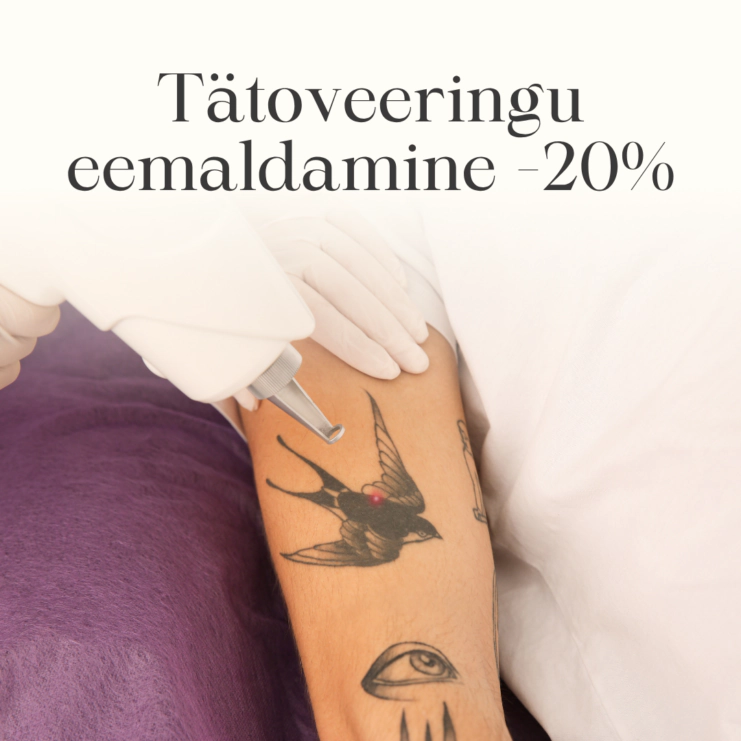 Tätoveeringu eemaldamine -20_ 1080x1080px WEB EST