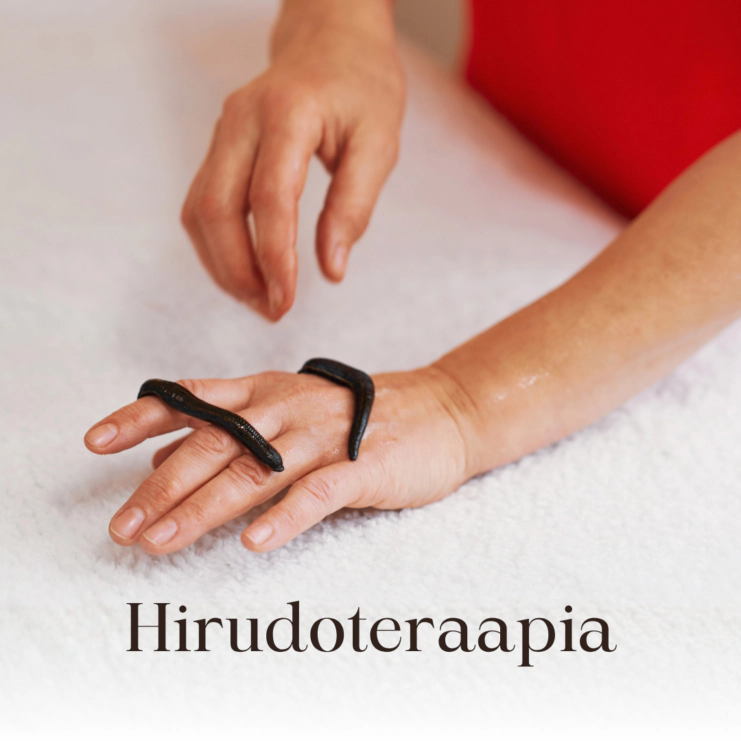 Hirudoteraapia _ WEB offers _ (1080x1080px) EST